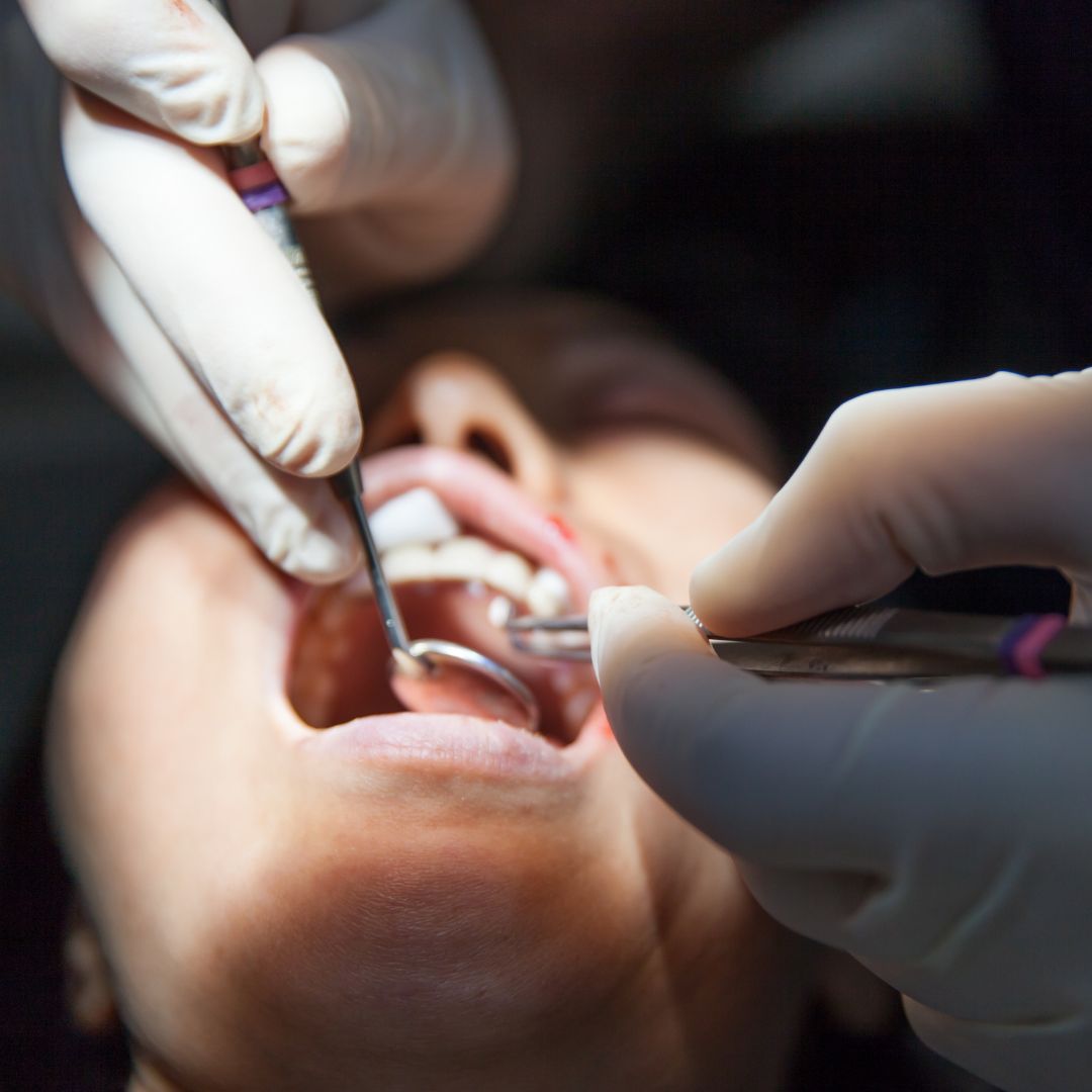 Oral Surgery