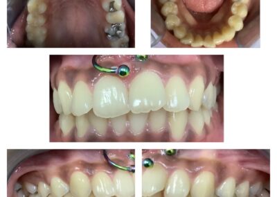 dentist rosenberg