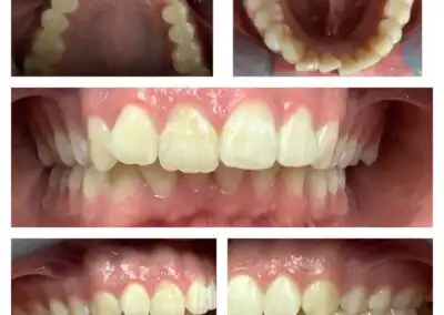 Dentist rosenberg tx