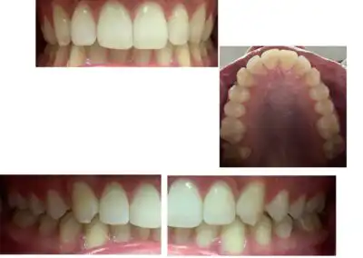 Dentist rosenberg tx